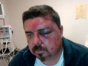 Chiclana says he sustained these injuries after an altercation with deputies in 2011.
